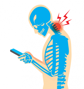 text neck